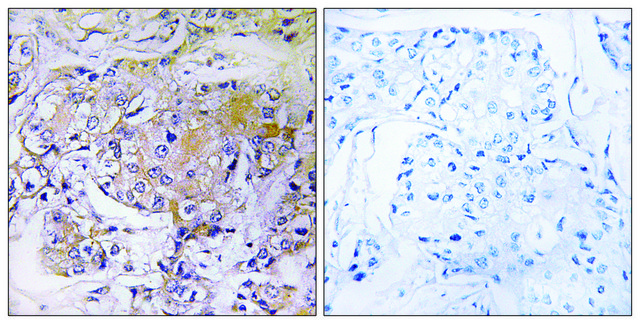 Anti-ULK3 antibody produced in rabbit affinity isolated antibody