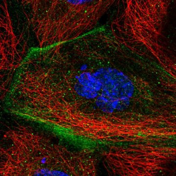 Anti-TMEM63B antibody produced in rabbit Prestige Antibodies&#174; Powered by Atlas Antibodies, affinity isolated antibody