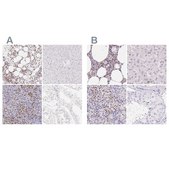 Anti-PADI4 antibody produced in rabbit Prestige Antibodies® Powered by Atlas Antibodies, affinity isolated antibody, buffered aqueous glycerol solution