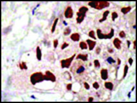 Anti-UBA2 (C-term A600) antibody produced in rabbit IgG fraction of antiserum, buffered aqueous solution