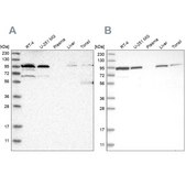 Anti-EFR3A antibody produced in rabbit Prestige Antibodies® Powered by Atlas Antibodies, affinity isolated antibody, buffered aqueous glycerol solution, Ab3