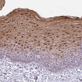 Anti-TGM3 antibody produced in rabbit Prestige Antibodies&#174; Powered by Atlas Antibodies, affinity isolated antibody, buffered aqueous glycerol solution