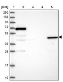 Anti-ANGPTL5 antibody produced in rabbit Prestige Antibodies® Powered by Atlas Antibodies, affinity isolated antibody, buffered aqueous glycerol solution