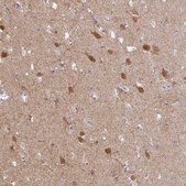 Anti-AMPD2 antibody produced in rabbit Prestige Antibodies® Powered by Atlas Antibodies, affinity isolated antibody, buffered aqueous glycerol solution