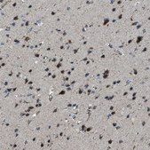 Anti-BCKDK antibody produced in rabbit Prestige Antibodies® Powered by Atlas Antibodies, affinity isolated antibody, buffered aqueous glycerol solution