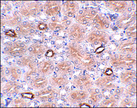 Anti-NOTUM antibody produced in rabbit affinity isolated antibody, buffered aqueous solution