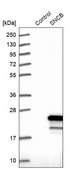 Anti-SNCB antibody produced in rabbit Prestige Antibodies® Powered by Atlas Antibodies, affinity isolated antibody, buffered aqueous glycerol solution