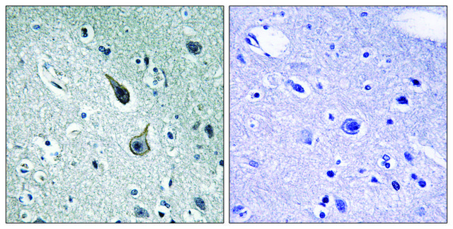 Anti-5-HT-2A antibody produced in rabbit affinity isolated antibody