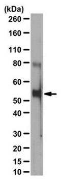 抗磷酸Beclin抗体（Thr119） from rabbit, purified by affinity chromatography