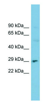 Anti-DNASE1 (N-terminal) antibody produced in rabbit affinity isolated antibody