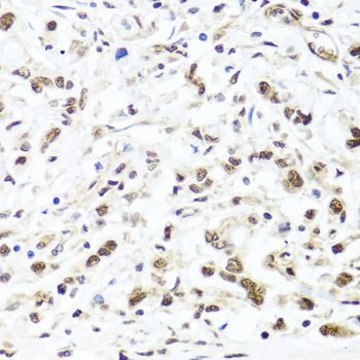 Anti- HIRA antibody produced in rabbit