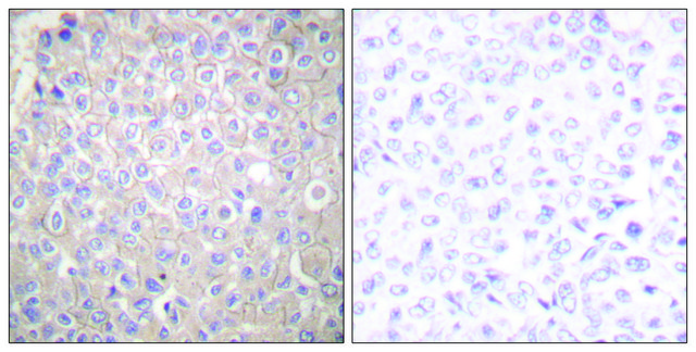 抗 E-钙黏蛋白 兔抗 affinity isolated antibody