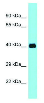 Anti-MFSD2A (N-terminal) antibody produced in rabbit affinity isolated antibody