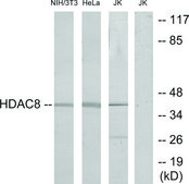 Anti-HDAC8 antibody produced in rabbit affinity isolated antibody
