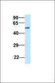 Anti-IGF2BP2 antibody produced in rabbit affinity isolated antibody