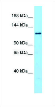 Anti-DENND1A antibody produced in rabbit affinity isolated antibody