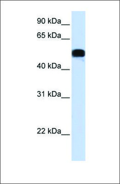 Anti-FOXA1 (ab2) antibody produced in rabbit affinity isolated antibody