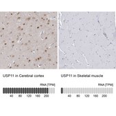 Anti-USP11 antibody produced in rabbit Prestige Antibodies® Powered by Atlas Antibodies, affinity isolated antibody, buffered aqueous glycerol solution