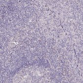 Anti-SRCIN1 antibody produced in rabbit Prestige Antibodies® Powered by Atlas Antibodies, affinity isolated antibody, buffered aqueous glycerol solution