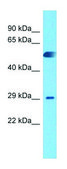 Anti-CEMP1 (C-terminal) antibody produced in rabbit affinity isolated antibody