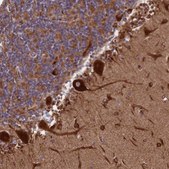 Anti-SPOCK2 antibody produced in rabbit Prestige Antibodies® Powered by Atlas Antibodies, affinity isolated antibody, buffered aqueous glycerol solution