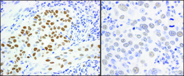 Rabbit anti-MCM5 Antibody, Affinity Purified Powered by Bethyl Laboratories, Inc.