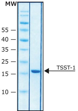 Toxic shock syndrome toxin-1 from Staphylococcus aureus