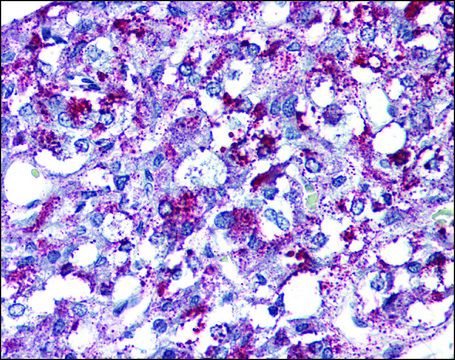 Anti-AGTR2 antibody produced in rabbit affinity isolated antibody