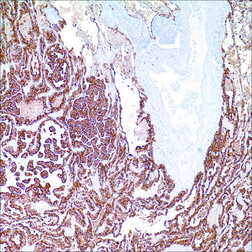 Cytokeratin 7 (OV-TL 12/30) Mouse Monoclonal Antibody