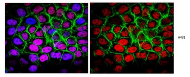 Anti-p53 (pantropic) Antibody, clone DO-1 clone DO-1, from mouse