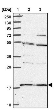 Anti-RPS18 antibody produced in rabbit Prestige Antibodies&#174; Powered by Atlas Antibodies, affinity isolated antibody, buffered aqueous glycerol solution