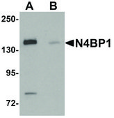 Anti-N4BP1 antibody produced in rabbit affinity isolated antibody