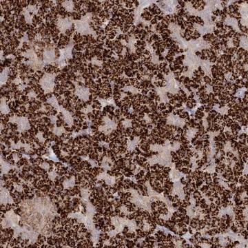 Anti-TGFBRAP1 antibody produced in rabbit Prestige Antibodies&#174; Powered by Atlas Antibodies, affinity isolated antibody, buffered aqueous glycerol solution