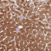 Anti-GYG2 antibody produced in rabbit Prestige Antibodies® Powered by Atlas Antibodies, affinity isolated antibody, buffered aqueous glycerol solution