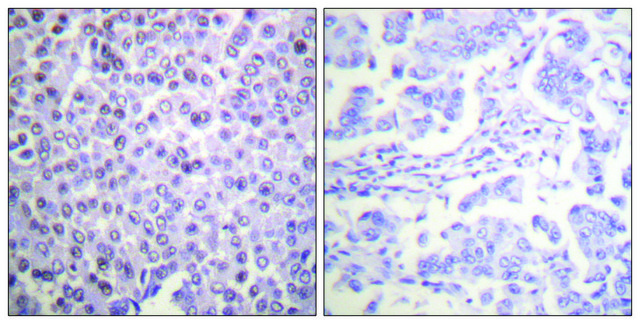 Anti-Histone H4 antibody produced in rabbit affinity isolated antibody