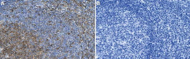 Anti-TUBB6 Antibody, clone 1F12 ZooMAb&#174; Rabbit Monoclonal recombinant, expressed in HEK 293 cells