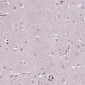 Anti-SLAMF8 antibody produced in rabbit Prestige Antibodies® Powered by Atlas Antibodies, affinity isolated antibody