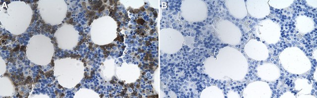 Anti-Siglec5/CD170 Antibody, clone 2J17 ZooMAb&#174; Rabbit Monoclonal recombinant, expressed in HEK 293 cells