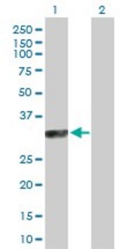 Anti-SYCP3 antibody produced in rabbit purified immunoglobulin, buffered aqueous solution