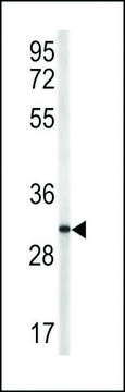 ANTI-TRAP(N-TERMINAL) antibody produced in rabbit purified immunoglobulin, buffered aqueous solution