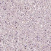 Anti-FMNL2 antibody produced in rabbit Prestige Antibodies® Powered by Atlas Antibodies, affinity isolated antibody, buffered aqueous glycerol solution
