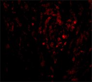 Anti-CIKS antibody produced in rabbit affinity isolated antibody, buffered aqueous solution
