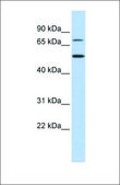 Anti-TBX3 antibody produced in rabbit affinity isolated antibody