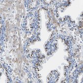 Anti-SLC45A3 antibody produced in rabbit Prestige Antibodies® Powered by Atlas Antibodies, affinity isolated antibody, buffered aqueous glycerol solution