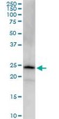 Monoclonal Anti-PGRMC2 antibody produced in mouse clone 2A3, purified immunoglobulin, buffered aqueous solution