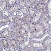 Anti-SLC16A8 antibody produced in rabbit Prestige Antibodies® Powered by Atlas Antibodies, affinity isolated antibody