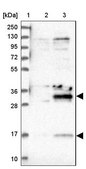 Anti-DTWD1 antibody produced in rabbit Prestige Antibodies® Powered by Atlas Antibodies, affinity isolated antibody, buffered aqueous glycerol solution