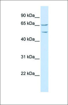 Anti-TTYH1 antibody produced in rabbit affinity isolated antibody