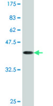 Monoclonal Anti-ACP1 antibody produced in mouse clone 2A3, purified immunoglobulin, buffered aqueous solution