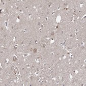 Anti-WDR44 antibody produced in rabbit Prestige Antibodies® Powered by Atlas Antibodies, affinity isolated antibody, buffered aqueous glycerol solution